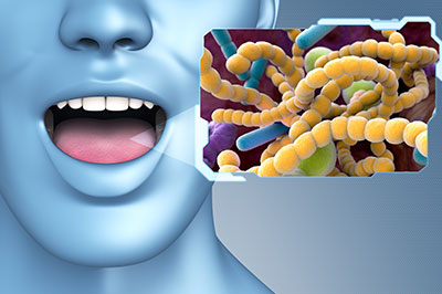 The image features a 3D rendering of a human face with an open mouth, displaying a microscopic view of bacteria within the throat, which is shown in a magnified close-up on the right side of the graphic.