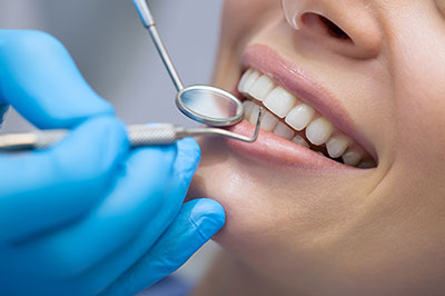 A dental hygienist using an instrument on a patient s teeth during a dental cleaning procedure.