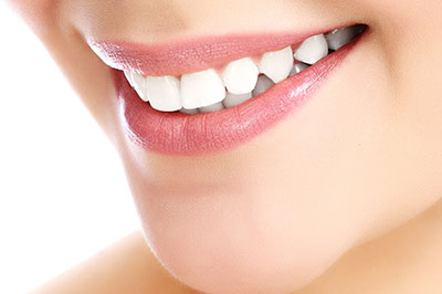 A close-up photo of a person s smiling face with teeth whitening treatment.