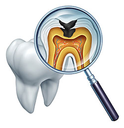 The image shows a magnified view of a tooth with an open crown, revealing the interior structure including the pulp chamber, nerve canals, and root system. A dental mirror with a magnifying glass is placed over the tooth, allowing for examination of these internal details.