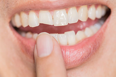 The image shows a close-up of a person s hand holding a toothbrush with a visible amount of toothpaste, and their mouth is open wide, revealing teeth that are being brushed.