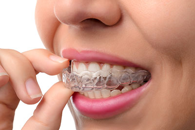 The image shows a person holding a toothbrush with braces on their teeth, demonstrating dental hygiene practices.