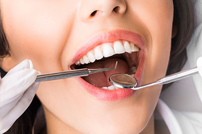 A woman with a toothy smile is receiving dental care, evident by the dental tools around her mouth.