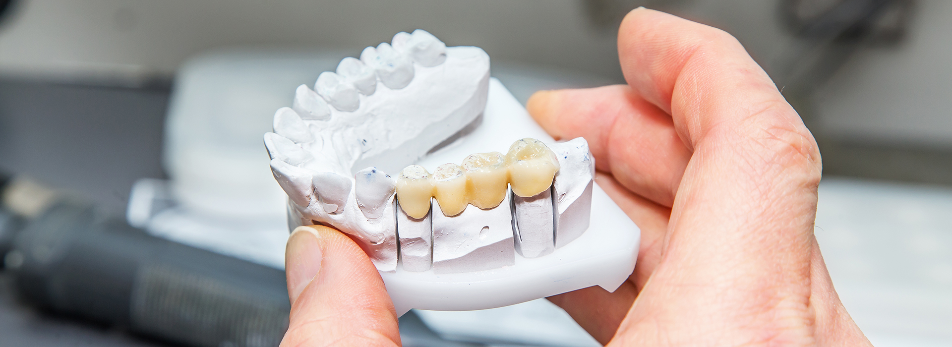 The image shows a person holding a 3D printed model of a dental implant with visible teeth and gumline details, demonstrating its design and structure.