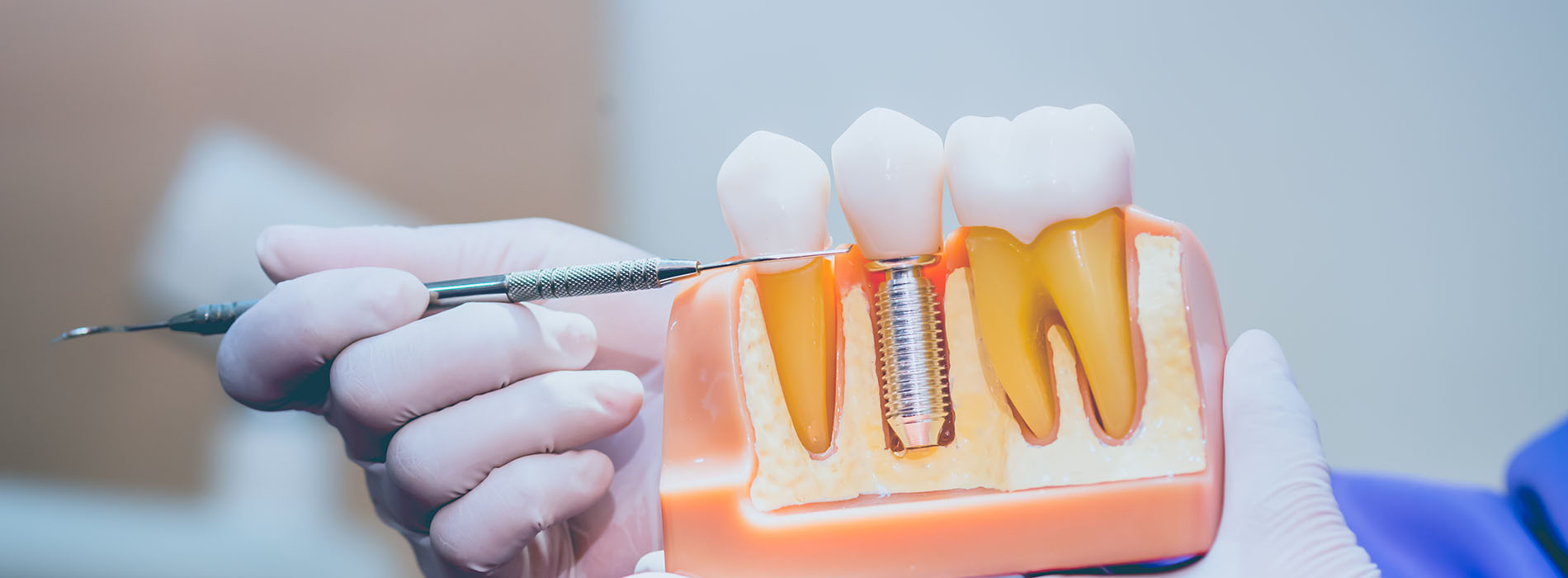 A person holding a small dental tool over an open tooth model with a yellowish substance inside.