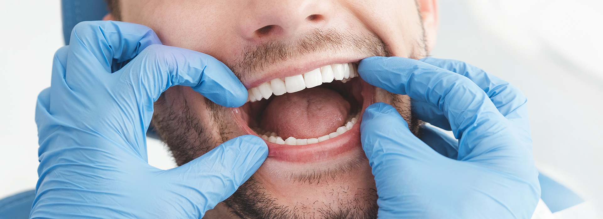 A person wearing blue gloves and a surgical mask holds their mouth open while making an exaggerated facial expression.