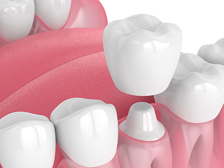 Dental Works of Malverne